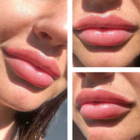 Lip Plumping Kit - Ravishine Beauty & Cosmetics